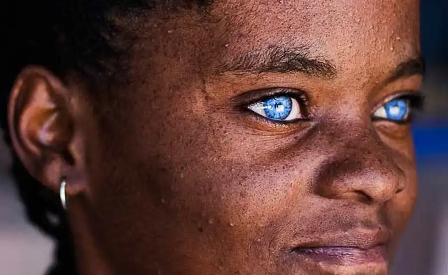 Black Person With Blue Eyes
