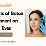 Botox Before and After Eyes