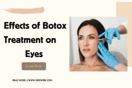 Botox Before and After Eyes