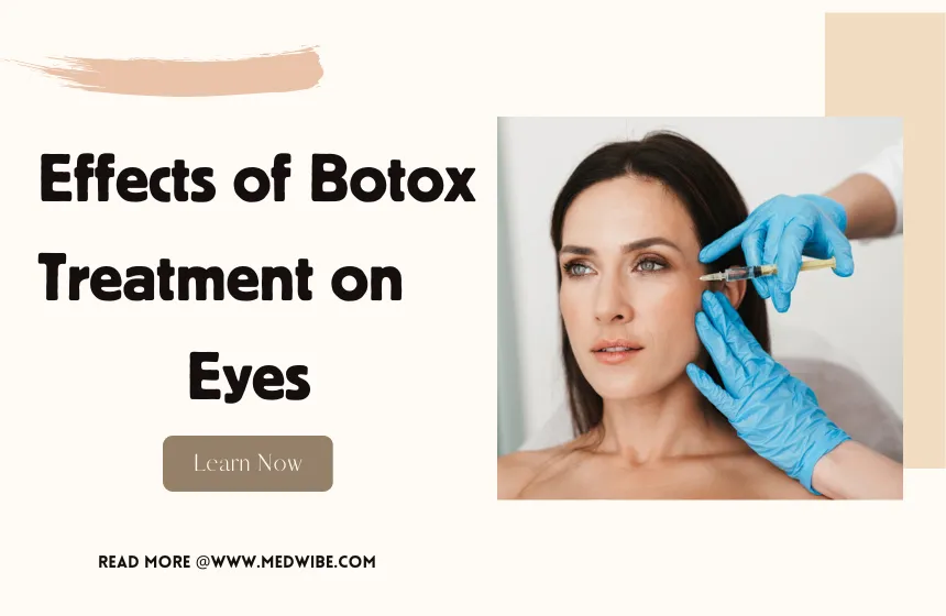 Botox Before and After Eyes